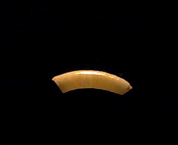 Caecum 2